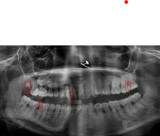 Dental OPG